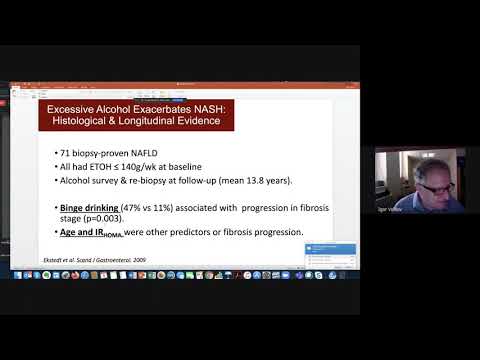 Enfermedad hepática secundaria a la combinacion de alcohol y sme metabólico