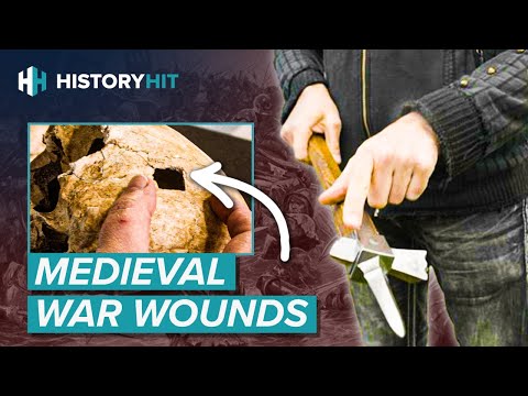 These Skeletons Reveal Horrific Injuries From The Battle of Towton