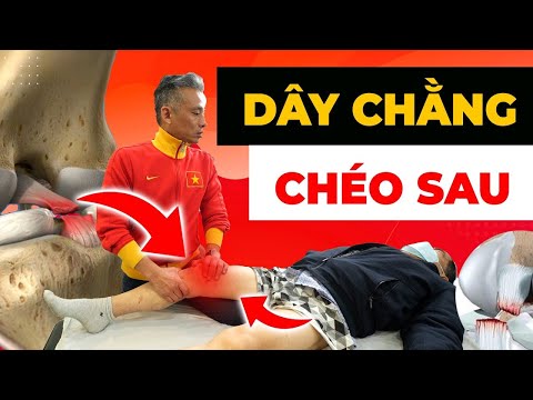 Đứt Dây Chằng Chéo Sau: Cơn Ác Mộng Mất Đi Khả Năng Vận Động