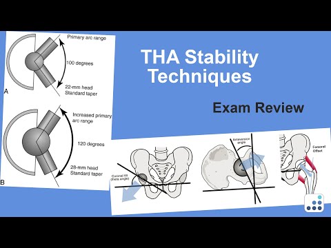 THA Stability Techniques Exam Review - William Griffin, MD