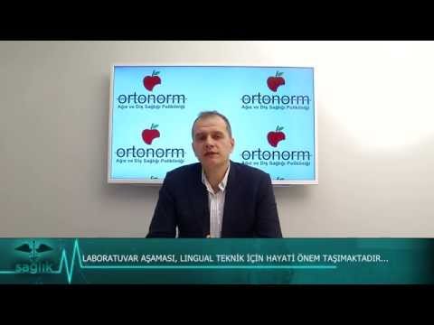 Lingual Ortodonti Nedir?