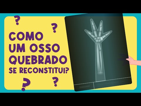 🟠 COMO UM OSSO QUEBRADO SE RECONSTITUI? 🦴❤️️ #BNCC - Aprenda com Luna! l O Show da Luna!