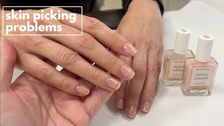 Skin picking problems