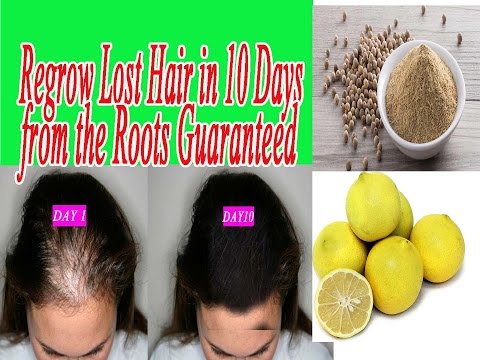 download lagu mp3 mp4 Lemon Seeds And Black Pepper For Baldness, download lagu Lemon Seeds And Black Pepper For Baldness gratis, unduh video klip Lemon Seeds And Black Pepper For Baldness