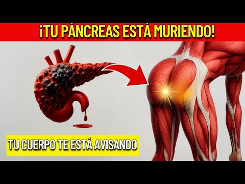 8 Síntomas Tempranos de Cáncer de Páncreas 🚨 ¡No Los Ignores!