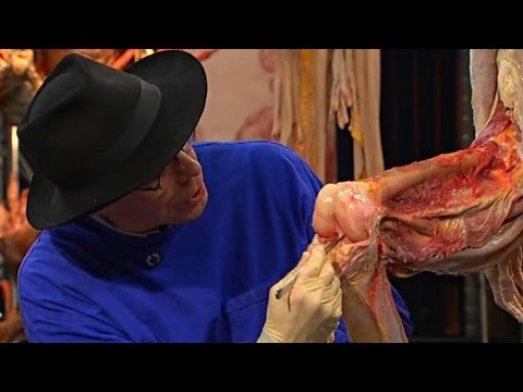 Indicazioni per artroscopia del ginocchio Dolore al ginocchio e il piede si gonfia