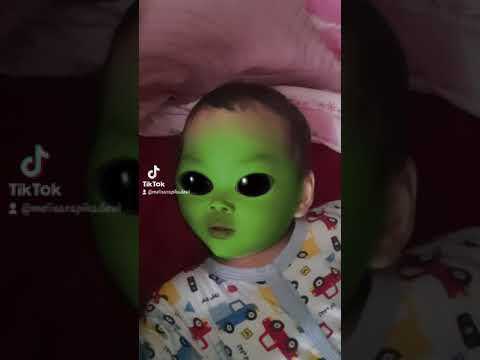 Akibat main hp , mata jd Hitam . #short