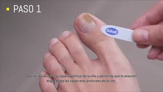 Scholl Cómo eliminar los hongos en las uñas anuncio