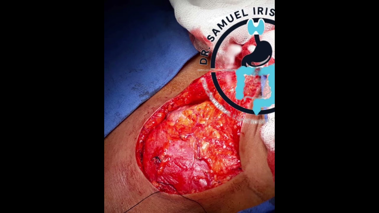 Samuel Irisson Mora-12