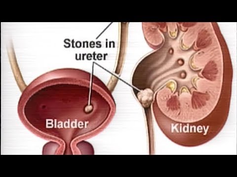 Channel Time - (2018-06-09) | ITN