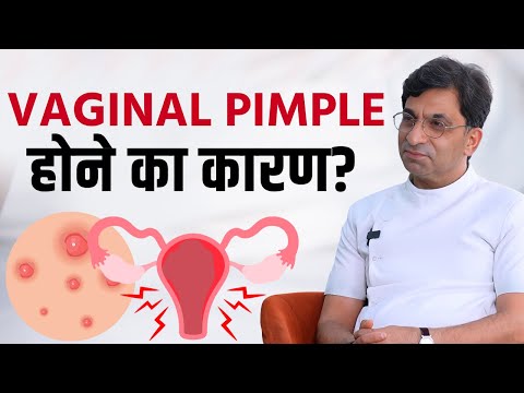Vaginal Pimple Reason: वजाइनल में पिम्पल होने के ये हैं कारण1 | The Healthsite