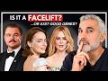 Plastic Surgeon Explains Celebrity Facelifts & Transformations at 2026 Oscars DEFAULT Thumbnail