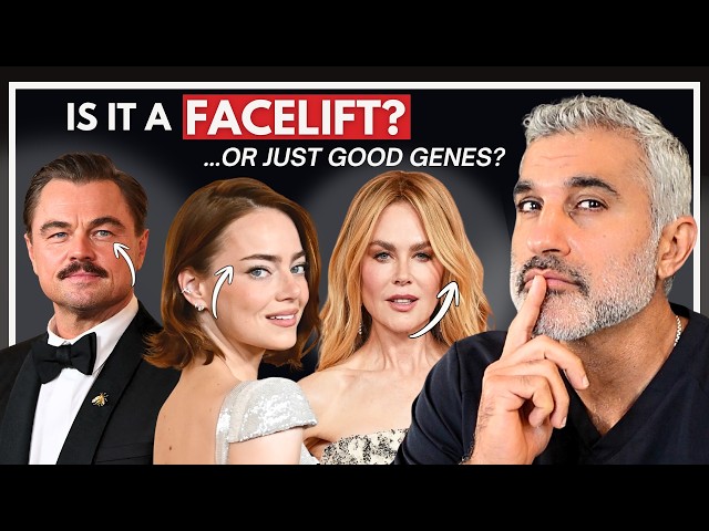 Plastic Surgeon Explains Celebrity Facelifts & Transformations at 2026 Oscars SDDEFAULT Thumbnail