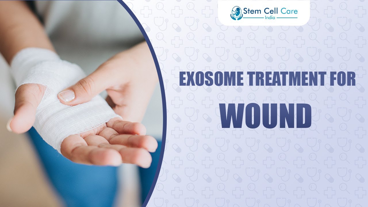 Exosome Treatment for Wound Healing | Advanced Regenerative Therapy