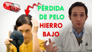 Pérdida de pelo por hierro bajo explicado por dermatólogo