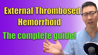External thromboses hemorrhoid: EVERYTHING you need to know!