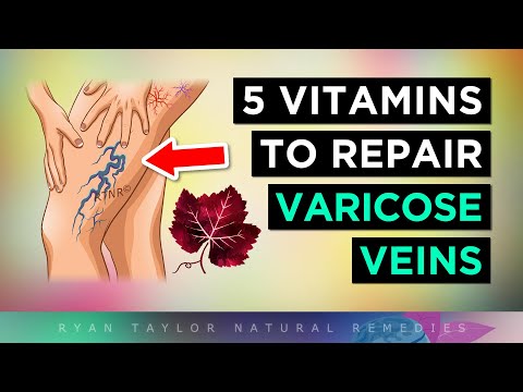 5 Vitamins For Venous Insufficiency (VARICOSE Veins Remedies)