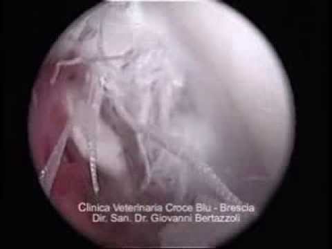 Osteocondrosi congiunta maxillo-facciale Trattamento delle articolazioni delle mani negli anziani