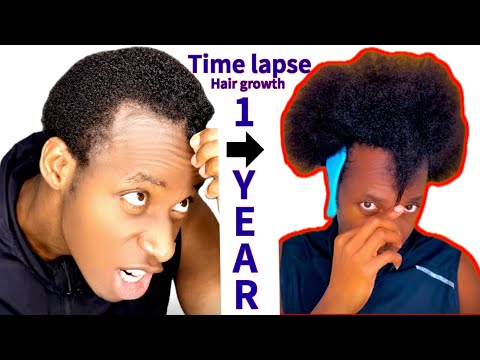 HAIR GROWTH TIME LAPSE(1 year WOLFIN).