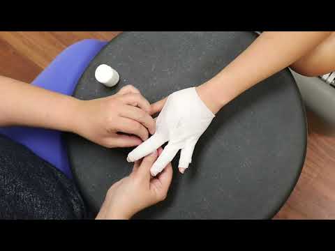 Lymphedema wrapping - hand, with help