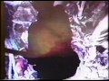 Medicine - Aruca (1992) HQ