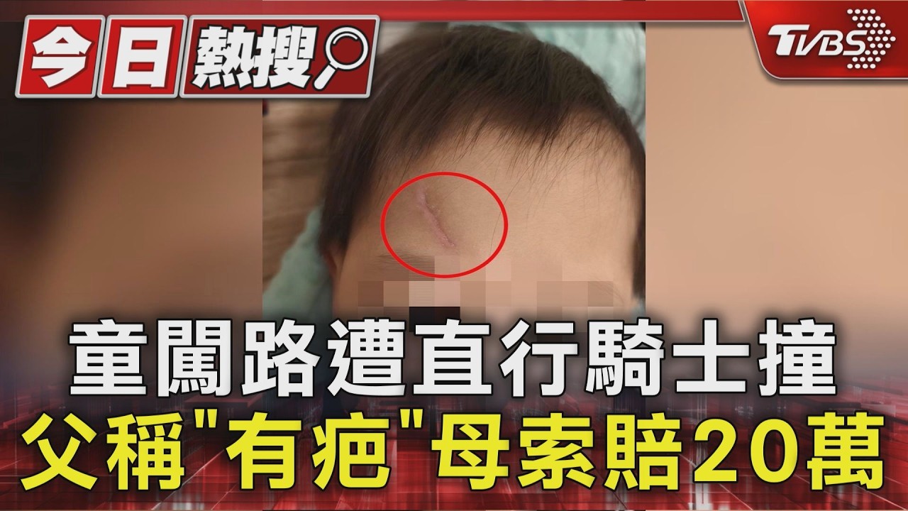 男童衝出馬路遭撞「滿臉血縫5針」 騎士怒嗆:開口就要20萬