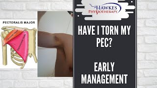 Have I torn my Pec?  Early management of a Pec tendon tear