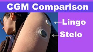 Dexcom Stelo vs Abbott Lingo — Which OTC CGM Is Better?