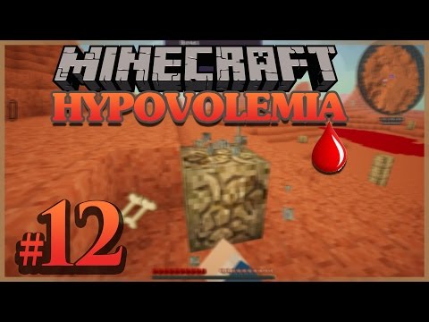 HYPOVOLEMIA FR ep 12 : MINECRAFT MODPACK [FR] Francais