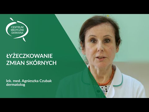 Koślawego palucha Guzki na palec z cieczą