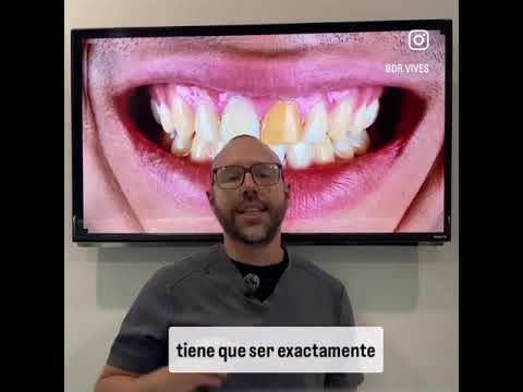 Francisco Jose Vives Serrano-47