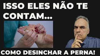 Como curar as pernas e pés inchados!