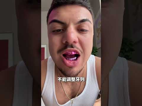 看着像牙套，其实是戴在牙齿上的首饰 #grillz #金属牙饰 #牙齿饰品 #科普 #涨知识