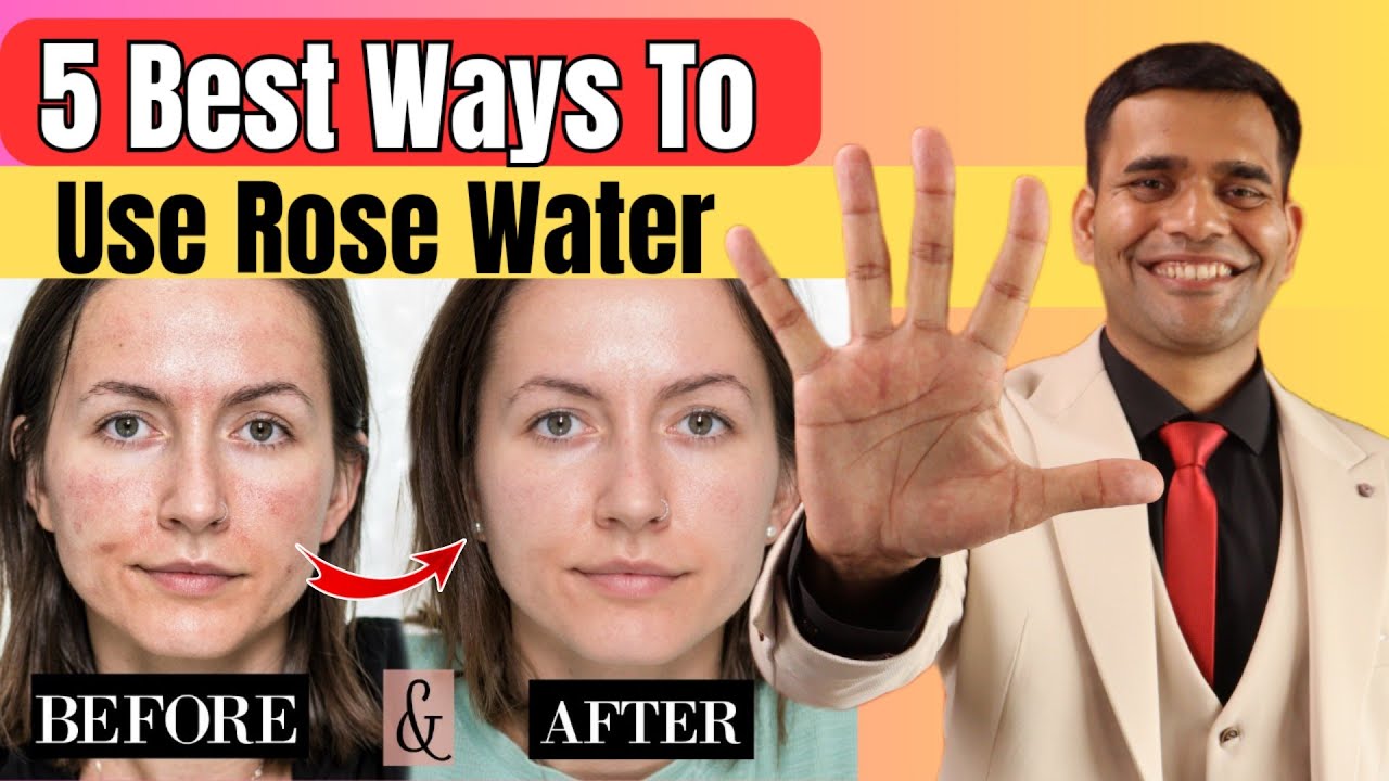 5 Best Ways To Use Rose Water - Dr. Vivek Joshi