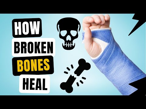 Why Do Bones Break & How Do Broken Bones Heal Themselves?