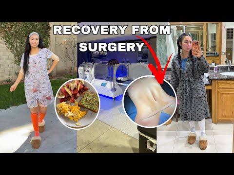 RECOVERING FROM MY SURGERY | ANSWERING ALL YOUR QUESTIONS 