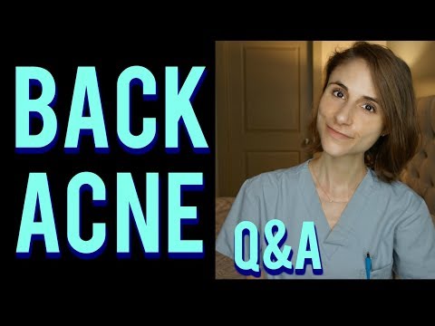 Back acne Q&A with a dermatologist: skin care tips