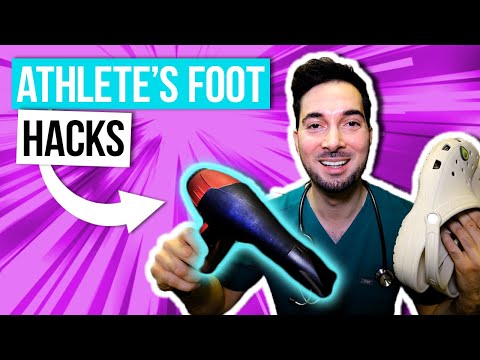 How to get rid of athlete's foot between toes removal and treatment