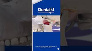 CRUJIDO DE MANDÍBULA al abrir la boca - ¿Por qué suena - #Shorts