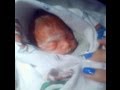 My Stillborn Story Including Pictures 