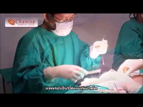 15 ปีของหน้าอกเล็กถ้าเธอจะเติบโต หน้าอกเล็กตาสีเขียว