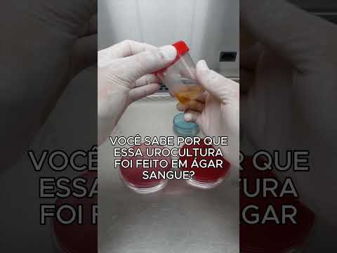 Como uma urocultura é feita no laboratório? #shorts #microbiologia