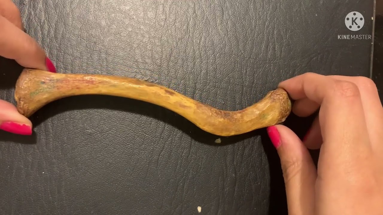 Ossification and Clincal Anatomy of Clavicle | Fractures of Clavicle | Part 4