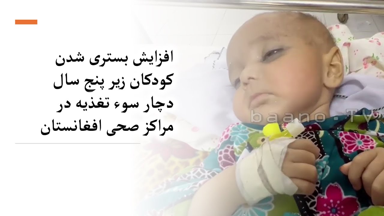 افزایش بستری شدن کودکان زیر پنج سال دچار سوء تغذیه در مراکز صحی افغانستان افزایش بستری شدن کودکان زیر پنج سال دچار سوء تغذیه در مراکز صحی افغانستان