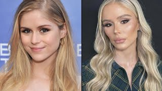 Erin Moriarty Ruined Her Face With Plastic Surgery...