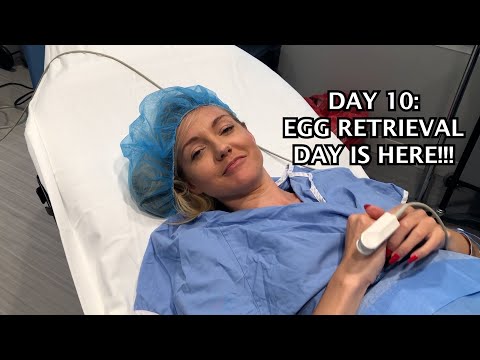 Watch my egg retrieval procedure and see my instant reaction when done: EGG FREEZING DAY 10 part 2
