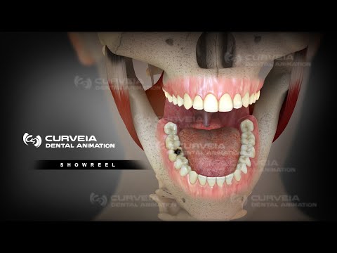 3D Dental Animation |  S H O W R E E L | Curveia Dental Animation