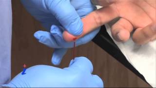 micro capillary plastic innovation  by zigmabiotech