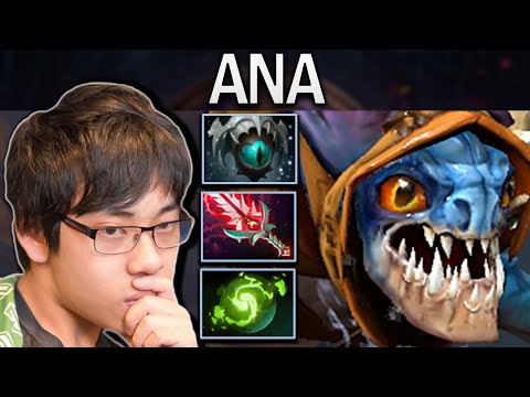 Slark Dota 2 Gameplay Miracle with Skadi - 31 Kills