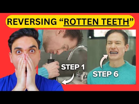 Dentist Reacts: How I Fixed My Terrible Teeth - 7 Steps | Bryan Johnson